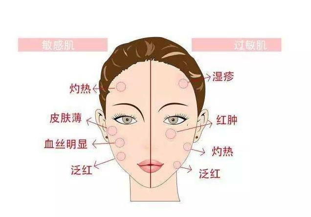 脸过敏发红痒怎么办？敏感肌肤适合用什么护肤品？