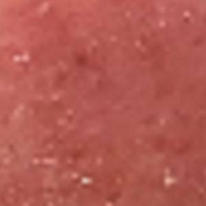 激素性皮炎治疗期间抹隔离霜、局部使用遮瑕粉底会怎样？